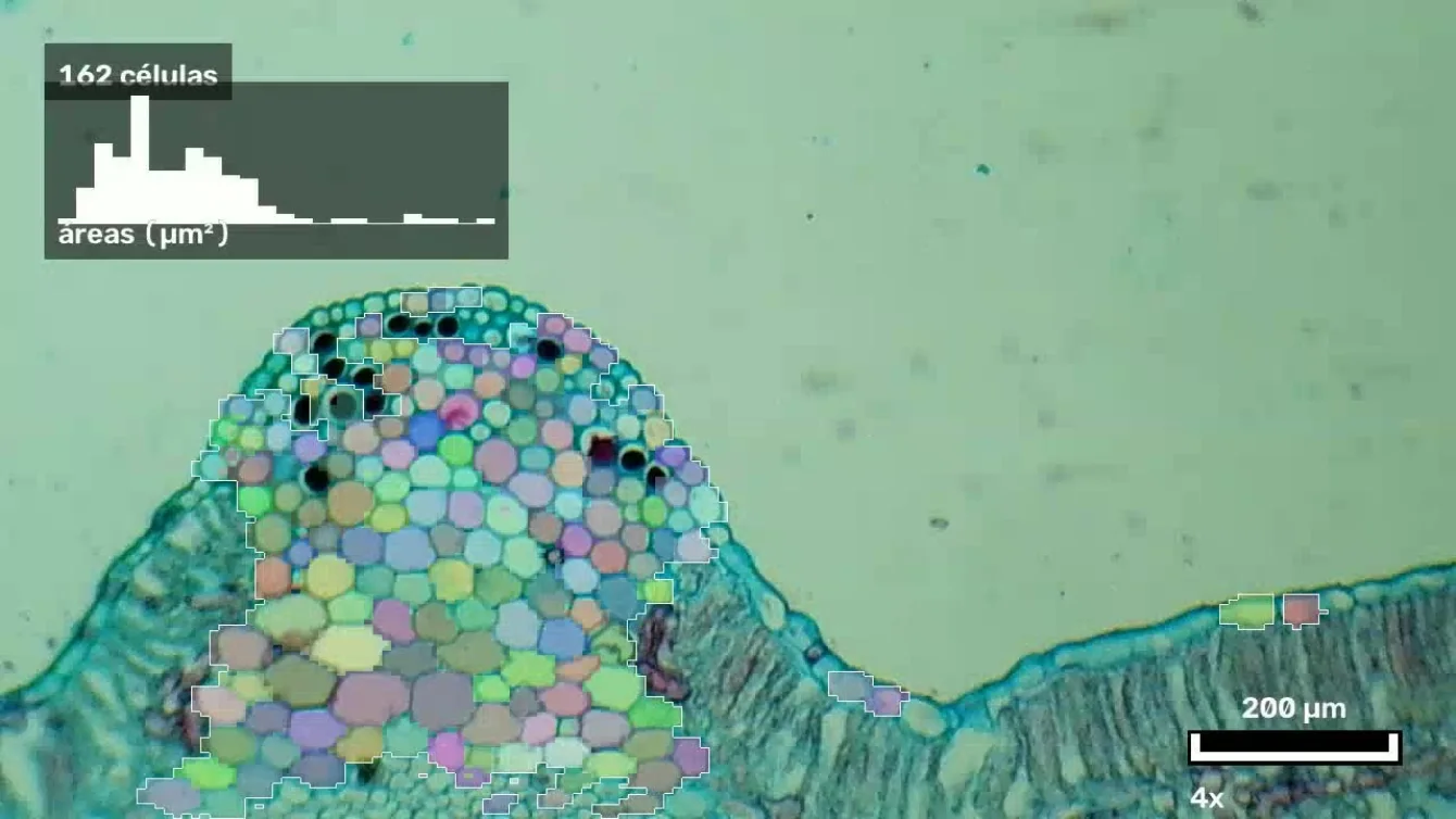 Vídeo del microscopio con las células detectadas y, bajo el conteo, un histograma de la distribución de tamaños
